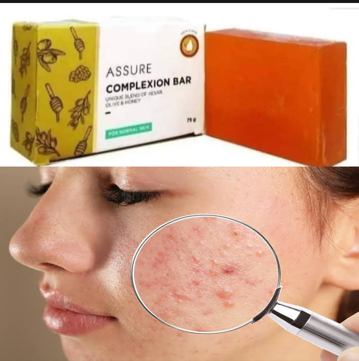Assure complexion ber 75mg